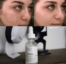 The Ordinary Alpha Arbutin 2% + HA 30 ml