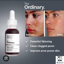 The Ordinary AHA 30% + BHA 2% Peeling Solution