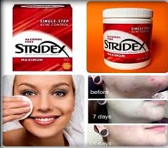 Stridex, Single-Step Acne Control, Maximum - 55 Soft Pad