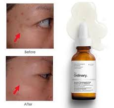The Ordinary Ascorbyl Tetraisopalmitate Solution 20% in Vitamin F, Hydrating Vitamin C Oil for Even Skin Tone, 1 Fl Oz