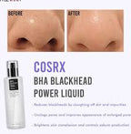 COSRX BHA Blackhead Power Liquid 100 ml