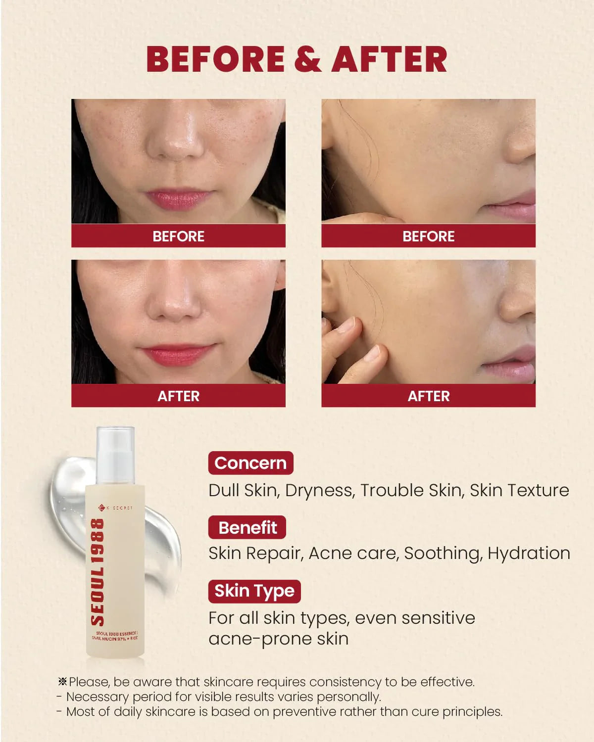 KSECRET Seoul 1988 Cream Snail Mucin 93% + Rice - image 5