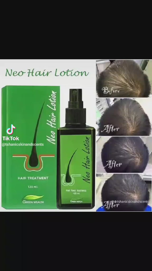 لوشن نيو للشعر