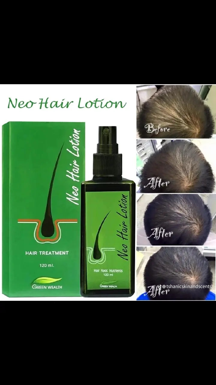 لوشن نيو للشعر