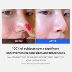 Medicube Zero Pore Pad – Dual-Textured AHA/BHA Toner Pads for Visible Pore Refining