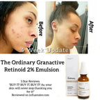 The Ordinary Granactive Retinoid 2% in Squalane 30 ml