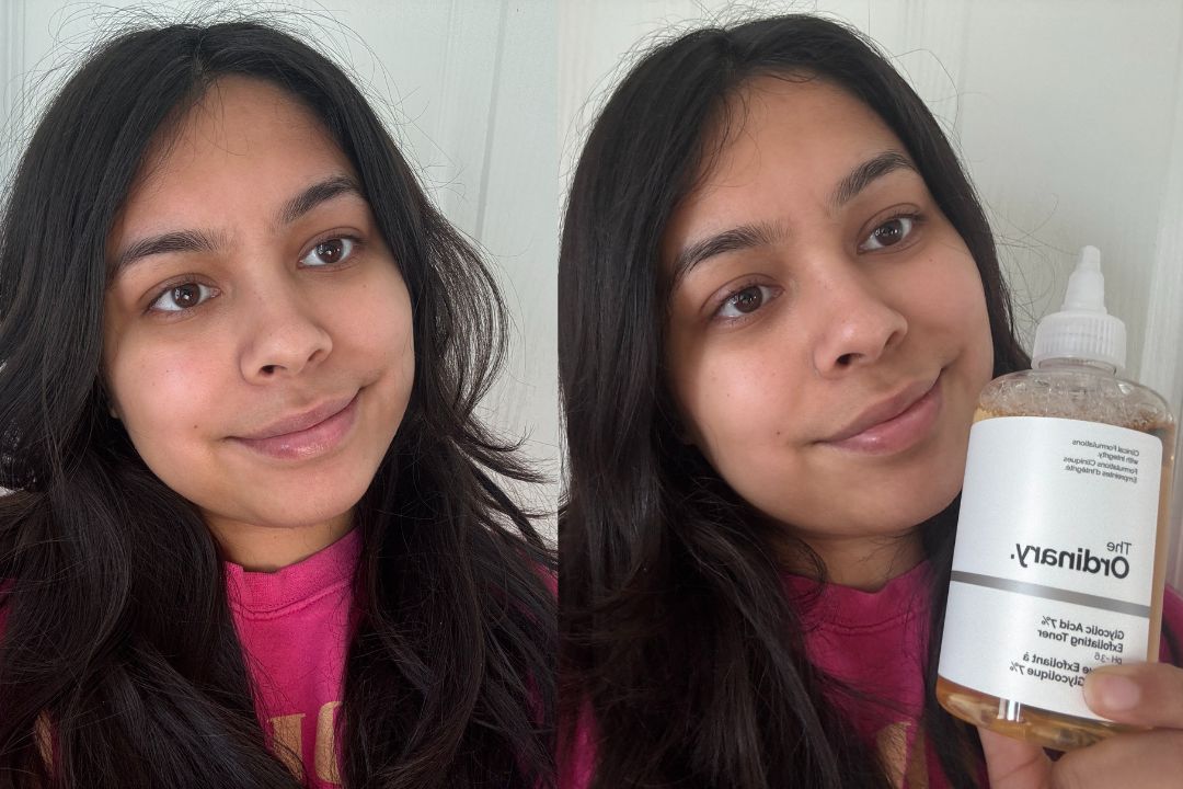 The Ordinary Glycolic Acid 7% Exfoliating Toner, Brightening and Smoothing Daily Toner for More Even-Looking Skin Tone, 8.1 Fl Oz