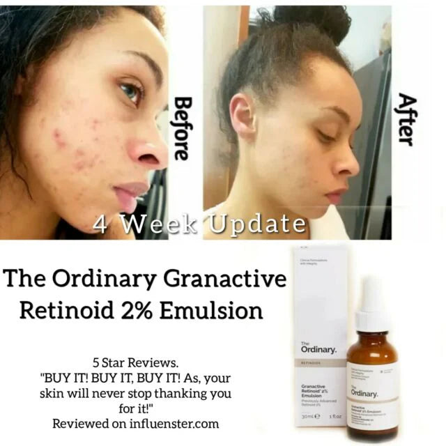 The Ordinary Granactive Retinoid 2% in Squalane 30ml - image 7