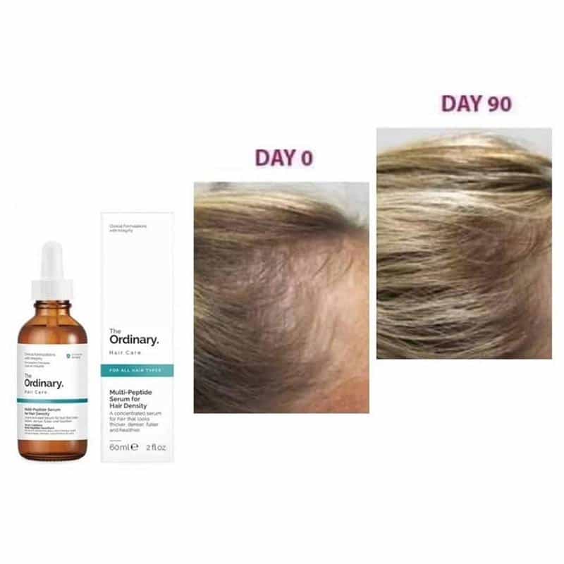 The Ordinary Multi-Peptide Serum for Hair Density 60ml - image 5
