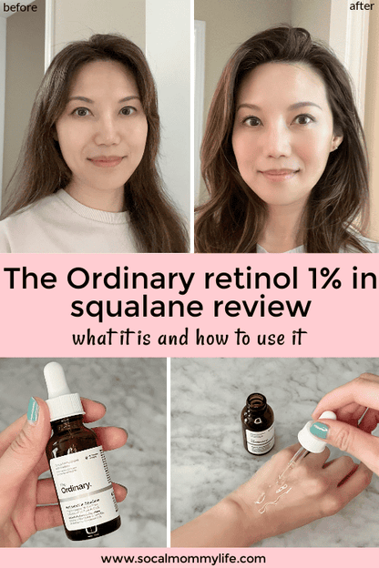 The Ordinary Retinol 0.5% in Squalane, Intermediate Retinol Serum for the Face That Is Anti-Aging and Skin Smoothing, 1 Fl Oz