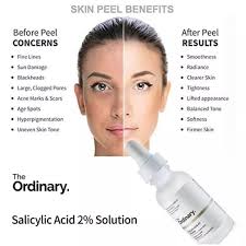 The Ordinary Salicylic Acid 2% Solution 30ml - image 7