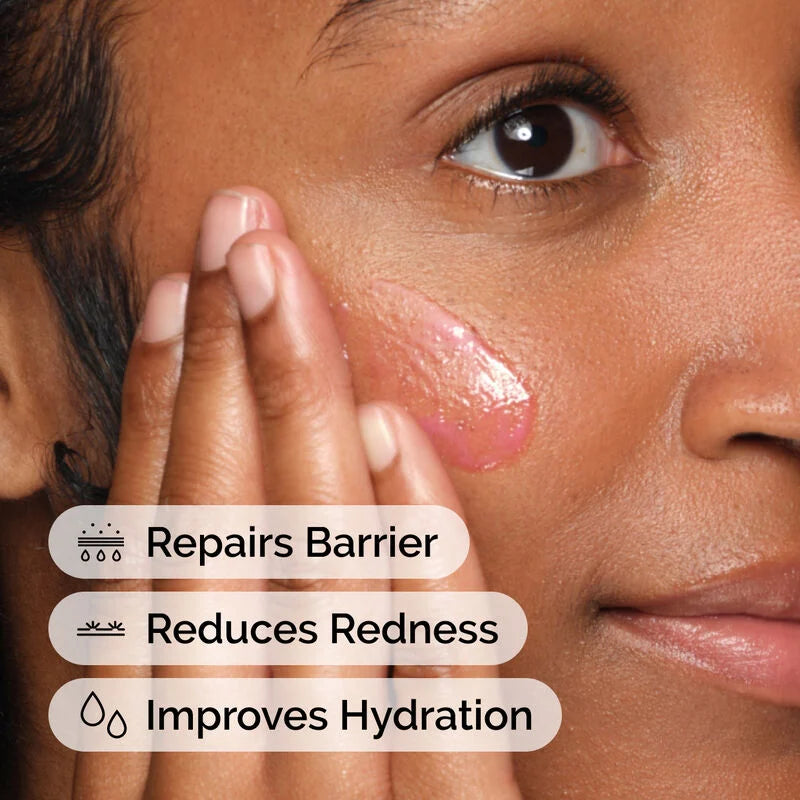 The Ordinary Soothing & Barrier Support Serum 30ml - image 5