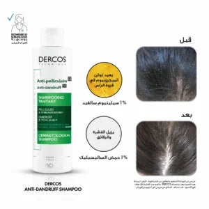 Vichy Dercos Anti Dandruff Shampoo for Sensitive Scalp 200ml