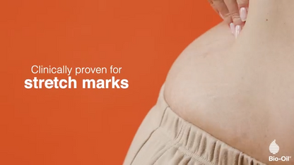 سيروم زيت الجسم للعناية بالبشرة من بيو-أويل لعلاج الندبات وعلامات التمدد، 200 مل